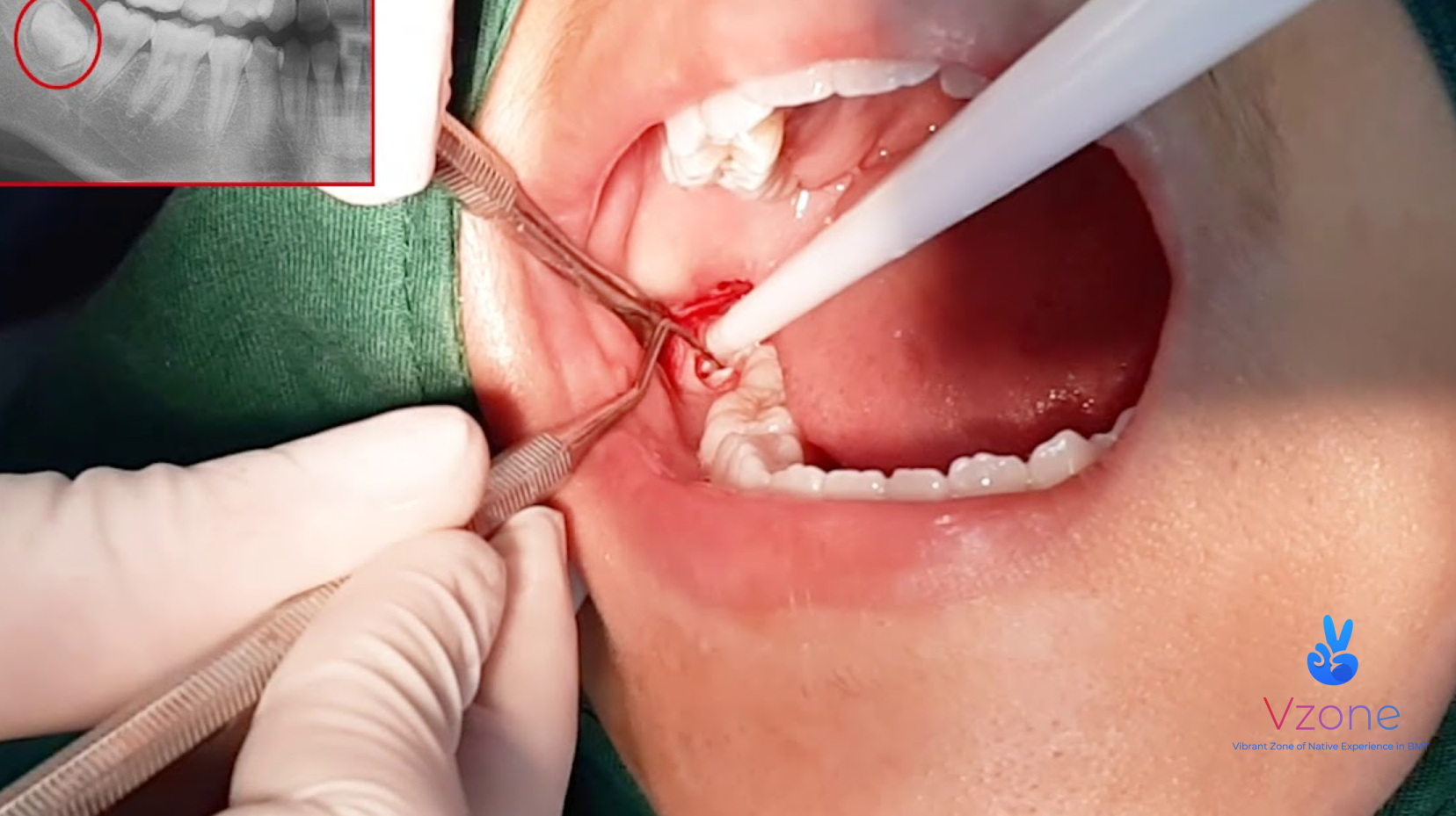 Tiêu chí chọn nha khoa uy tín