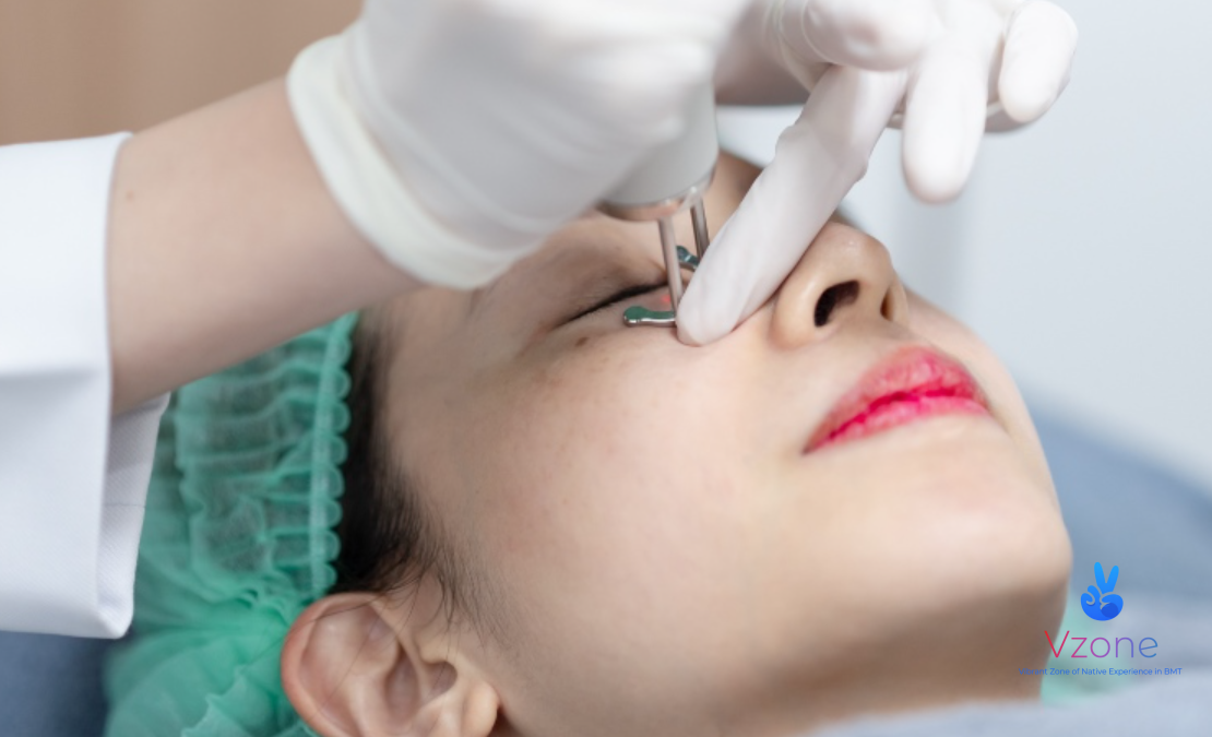 Các phương pháp trị thâm quầng mắt phổ biến tại BMT và chi phí